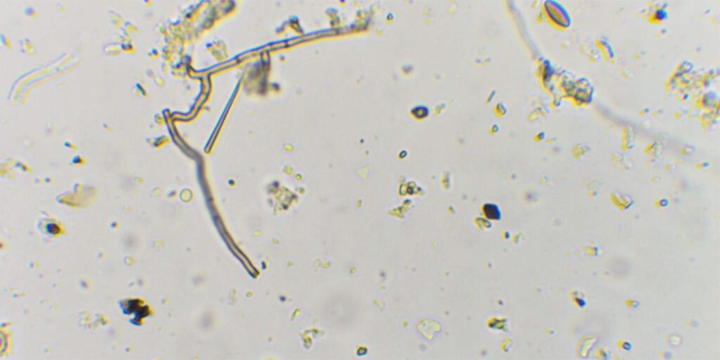 te de compost al  microscopi