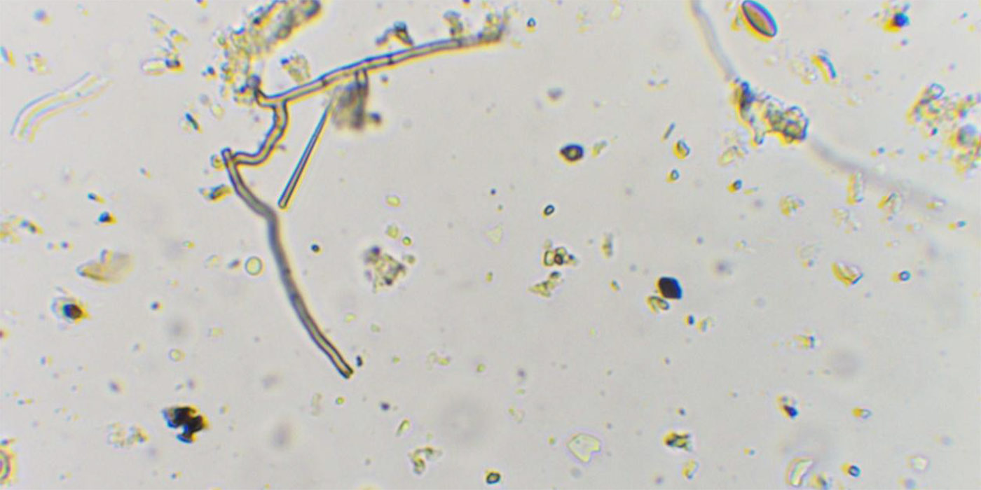 te de compost al microscopi