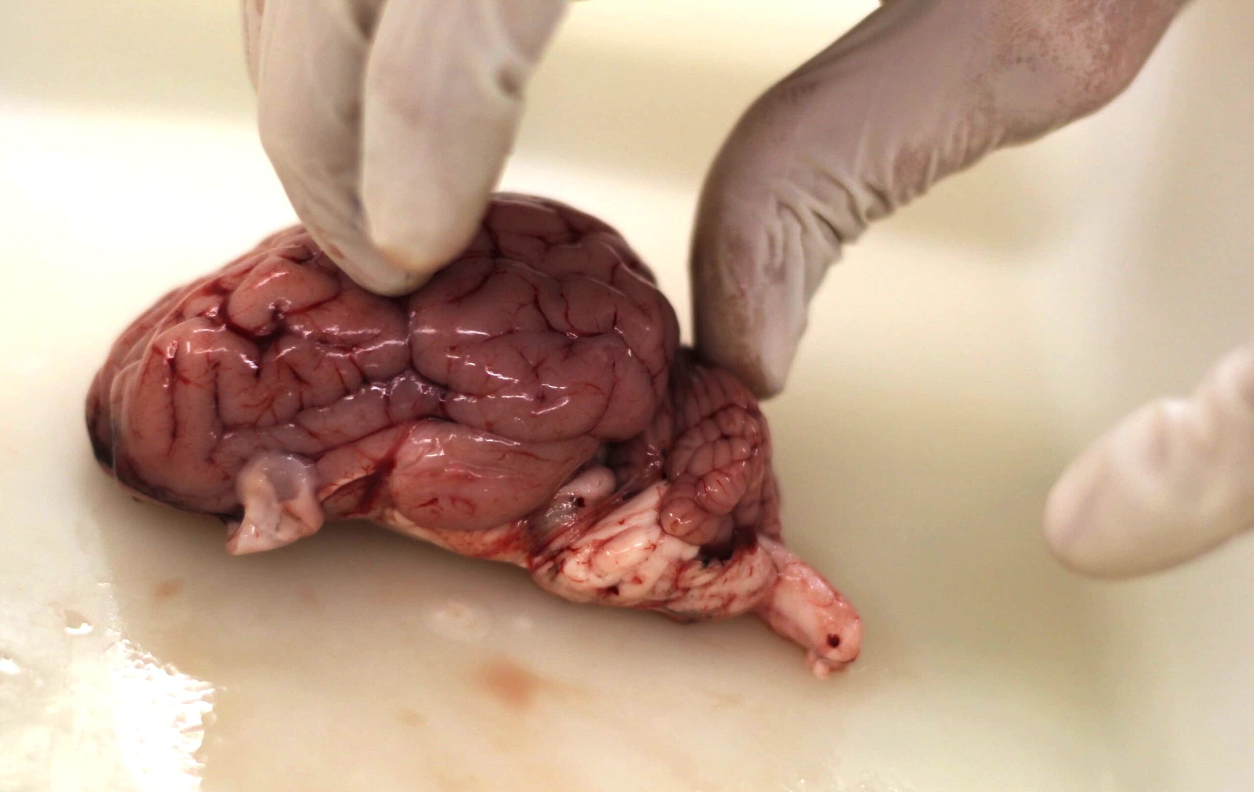 Encèfal vista lateral