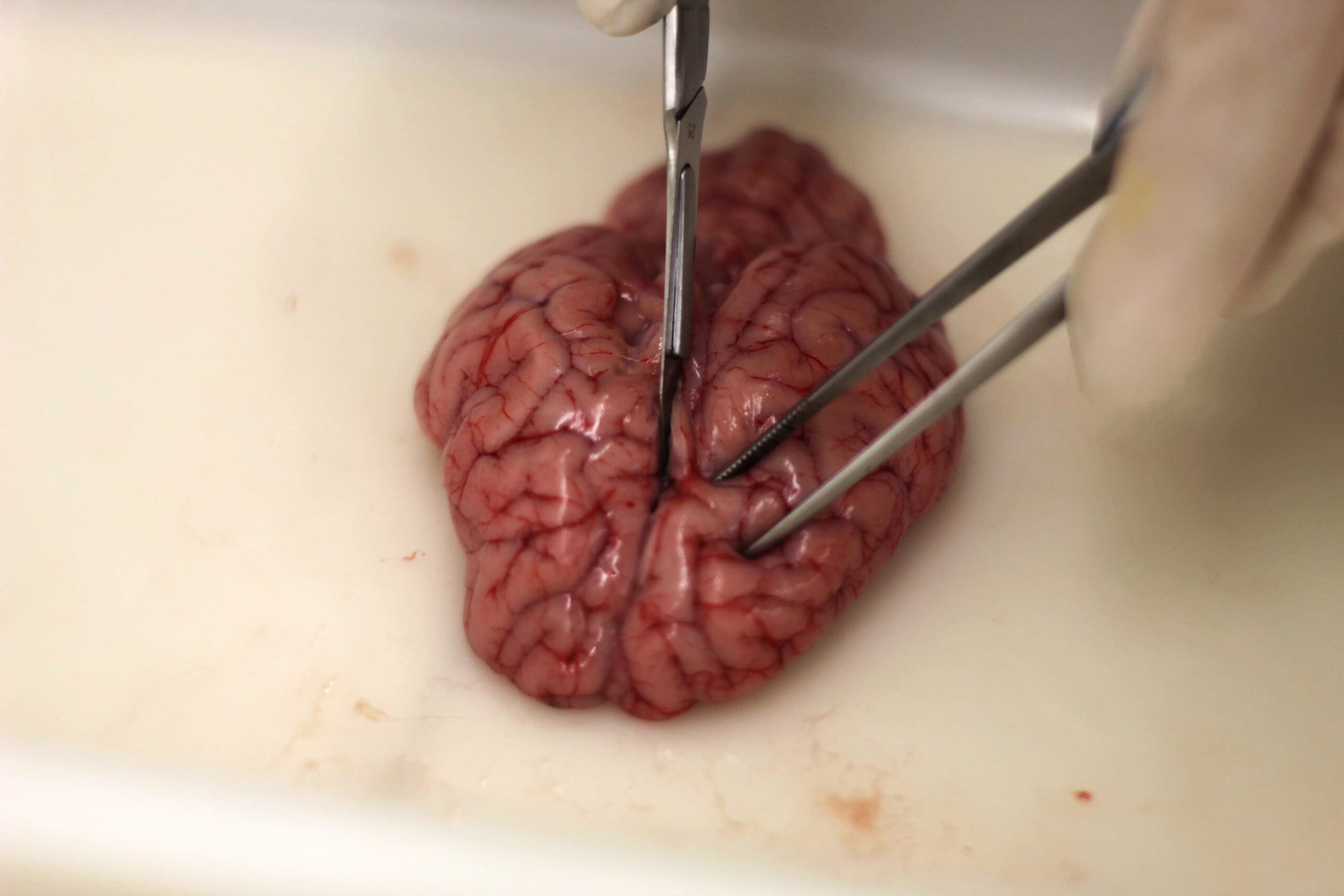 Dissecció - tall sagital