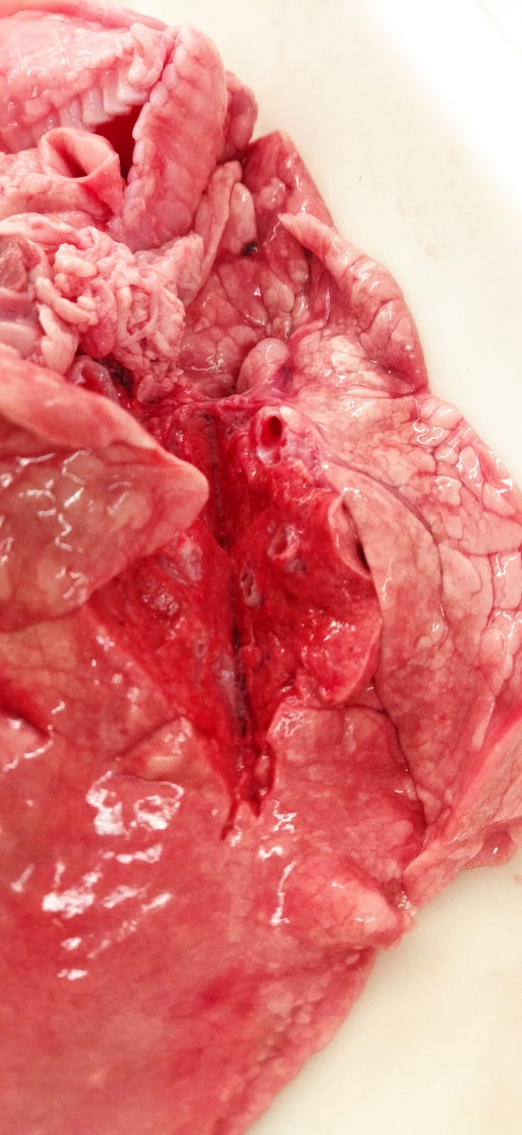 Teixit pulmonar intern