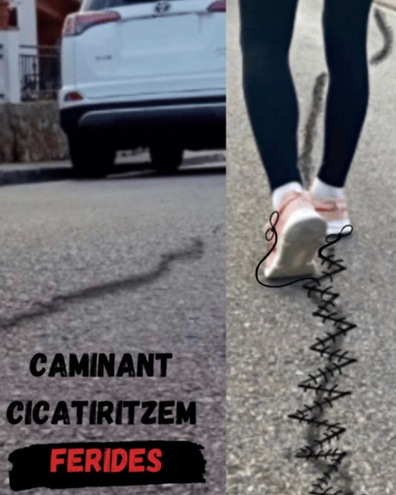 Cicatritzem ferides - còpia